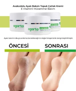 Alternative view of Agarta Ayak ve Topuk Çatlak Bakım Kremi 100 mL