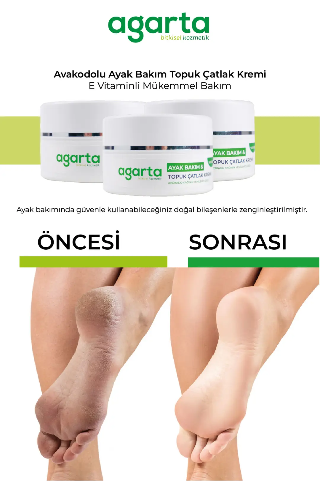 Agarta Ayak ve Topuk Çatlak Bakım Kremi 100 mL - Görsel 2
