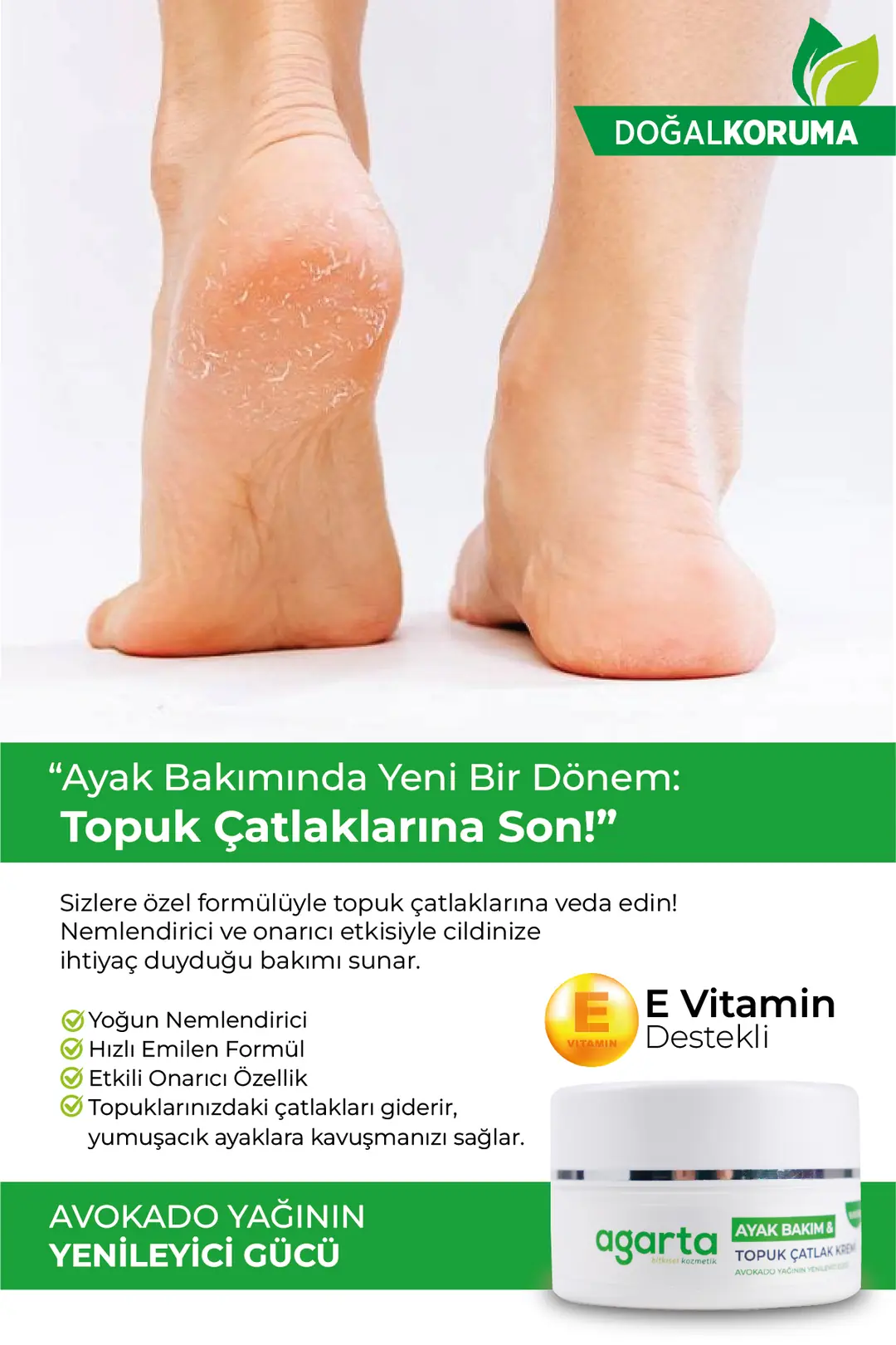 Agarta Ayak ve Topuk Çatlak Bakım Kremi 100 mL - Görsel 3